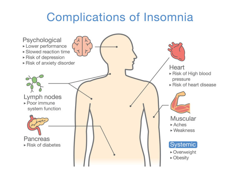 What Is Insomnia A Mindful Way 